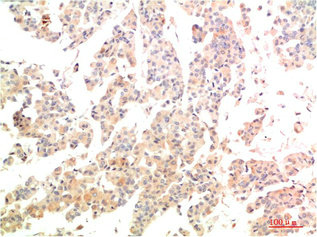 Anti-MAP2K3 Antibody