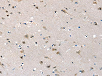 Anti-SLC6A7 Antibody