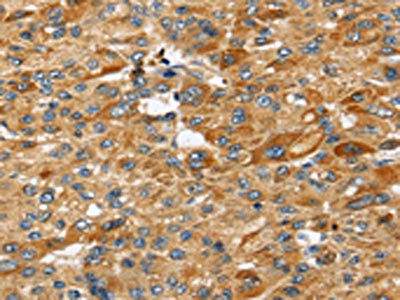 Anti-STC2 / Stanniocalcin 2 Antibody