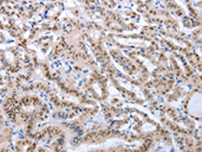 Anti-PAX8 Antibody