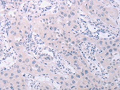 Anti-PKD2L1 Antibody