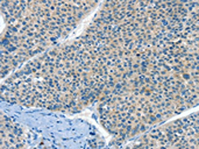 Anti-HID1 Antibody