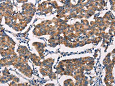 Anti-SPR Antibody