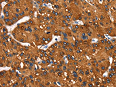 Anti-MT-CYB Antibody