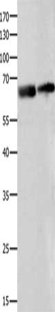 Anti-IGF2BP2 / Insulin-like growth factor 2 mRNA-binding protein 2 Antibody