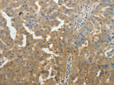 Anti-SYT6 / Synaptotagmin 6 Antibody