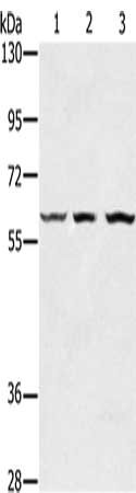 Anti-OXSR1 Antibody