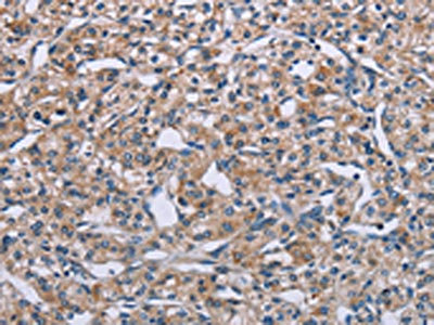 Anti-PLXNA2 Antibody