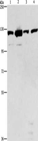 Anti-PTK2 Antibody