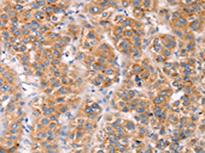 Anti-MLNR Antibody