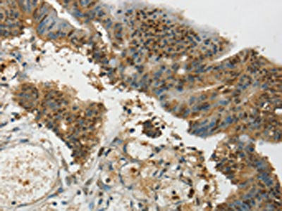 Anti-SYCP1 / Synaptonemal complex protein 1 Antibody