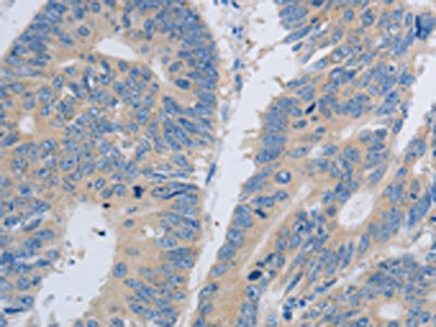 Anti-PAWR Antibody