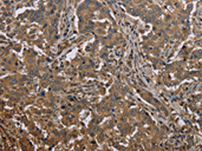 Anti-MCC Antibody
