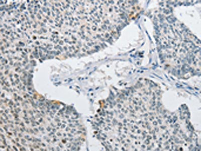 Anti-AP2M1 / AP-2 complex subunit mu Antibody