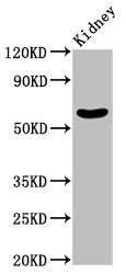 Anti-MGAT3 Antibody
