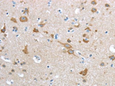 Anti-HCN4 Antibody