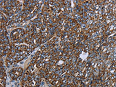 Anti-NDUFA13 Antibody