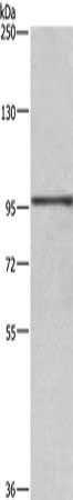 Anti-RB1 Antibody