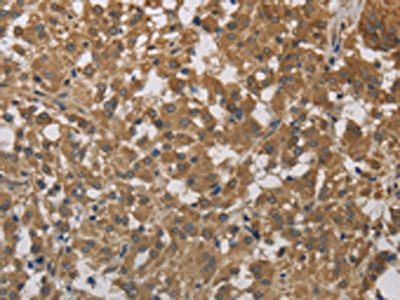 Anti-CYB5A / Cytochrome b5 type A Antibody