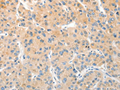 Anti-RPN1 Antibody