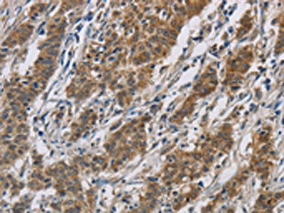 Anti-SIGMAR1 Antibody