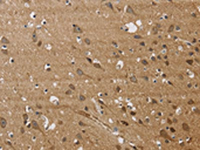 Anti-JAG1 / CD339 Antibody