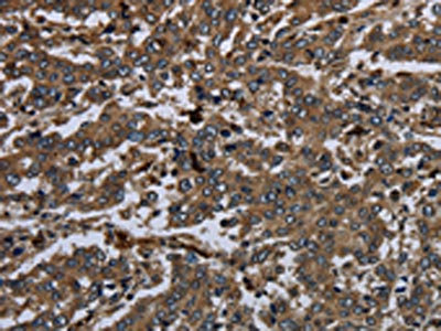 Anti-GP1BA / CD42b alpha Antibody