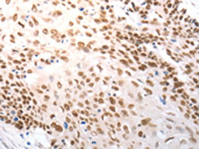 Anti-SLC22A8 Antibody