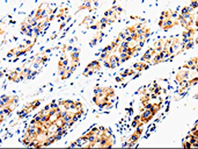 Anti-COX16 Antibody