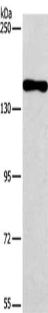 Anti-PDS5B Antibody