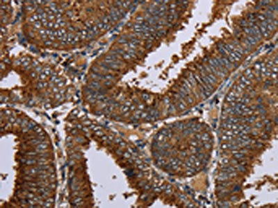 Anti-OCC1 Antibody