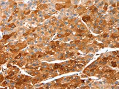 Anti-CIDEC Antibody