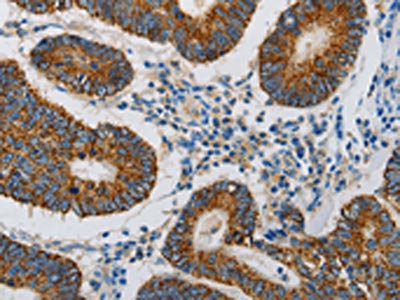 Anti-MAP3K5 / ASK1 Antibody