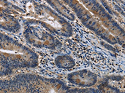 Anti-ITPR2 / Inositol 1