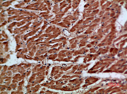 Anti-ARTN / Artemin Antibody
