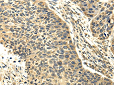 Anti-RASD2 Antibody
