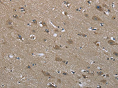 Anti-SYT3 / Synaptotagmin 3 Antibody