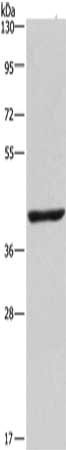 Anti-NME7 Antibody
