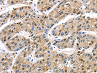 Anti-TAB1 / TGF-beta-activated kinase 1 and MAP3K7 binding protein 1 Antibody