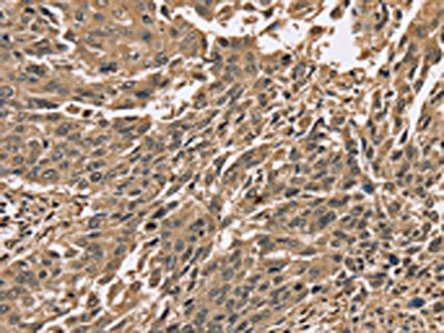 Anti-PPP1CC Antibody