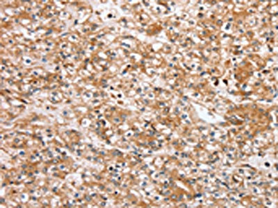 Anti-SLC25A20 Antibody