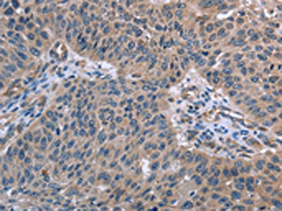 Anti-RNF144B Antibody