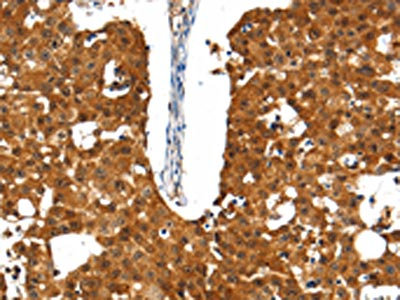 Anti-SSTR5 Antibody