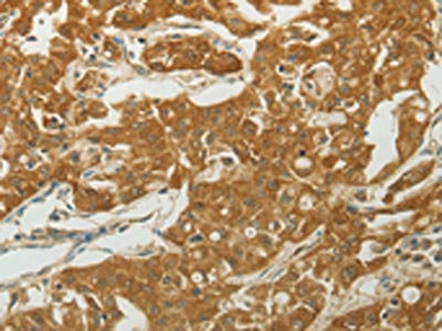 Anti-MC4R Antibody