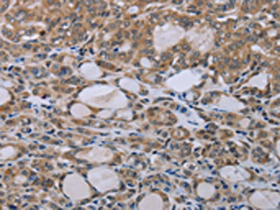Anti-NAIP Antibody