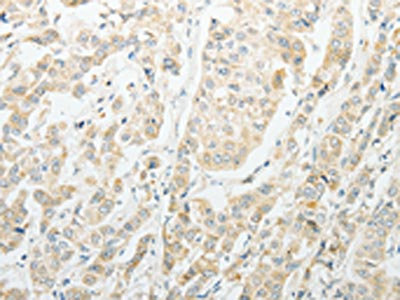 Anti-AGBL1 / ATP/GTP binding protein-like 1 Antibody