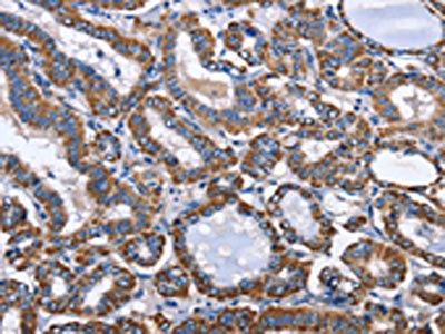Anti-INTS10 / Integrator complex subunit 10 Antibody