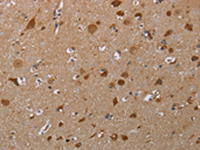 Anti-MARK1 Antibody