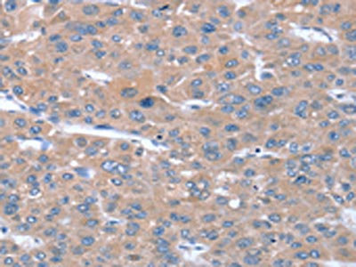 Anti-SULF1 / Extracellular sulfatase Sulf-1 Antibody