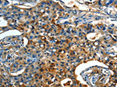 Anti-ORM1 Antibody